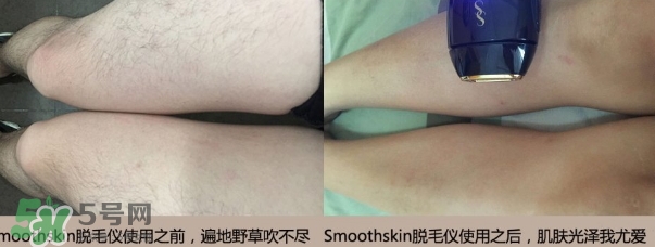smoothskin和slikn infinity哪個好？smoothskin脫毛儀怎么樣