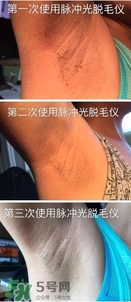 松下es wh93脫毛儀怎么樣？松下es wh93脫毛儀多少錢