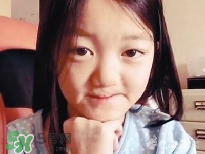 兔唇是什么？兔唇是什么原因造成的？