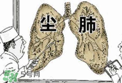 一般幾年時間會有塵肺病？塵肺病的早期癥狀