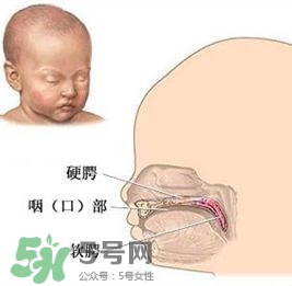 兔唇能檢查出來嗎？兔唇能完全修復(fù)嗎？