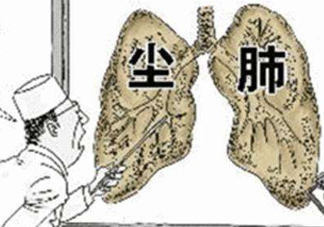 塵肺病能治愈嗎？塵肺病能活多久