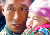 兔唇是什么？兔唇是什么原因造成的？