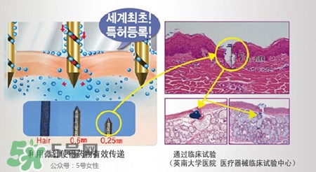 珠兒麗蚊子針好用嗎？珠兒麗蚊子針副作用