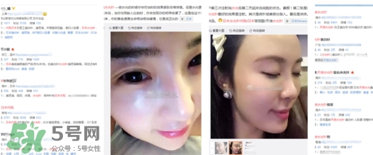 天倍面膜是日本的嗎？日本tenbe天倍面膜騙局