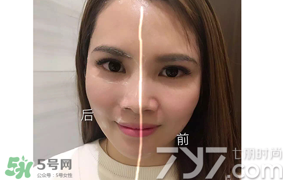 黃金棒有什么用？黃金棒的功效與作用