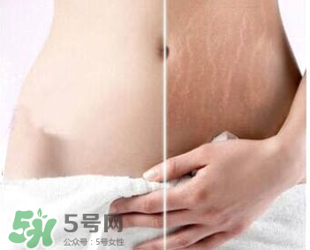 妊娠紋怎么長在大腿上了？妊娠紋會不會長在大腿上？
