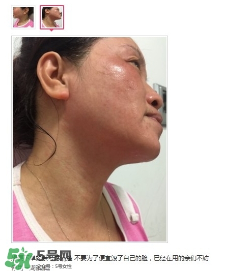 肌膚之食是什么牌子？肌膚之食讓我毀容了