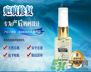 帕瑪氏疤痕修復(fù)有效果嗎？帕瑪氏疤痕修復(fù)怎么樣？