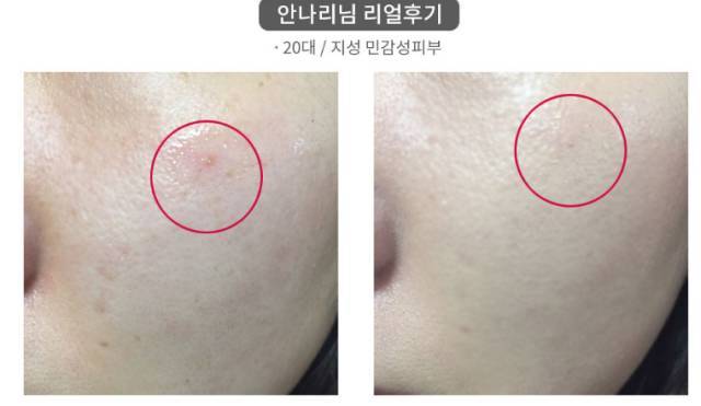 real skin patch怎么樣？real skin是什么牌子