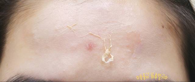 real skin patch怎么樣？real skin是什么牌子