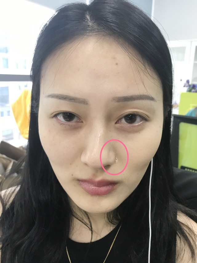 real skin patch怎么樣？real skin是什么牌子