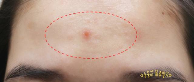 real skin patch怎么樣？real skin是什么牌子