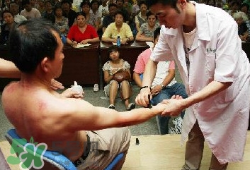 刮痧痛嗎？刮痧疼還是拔罐疼