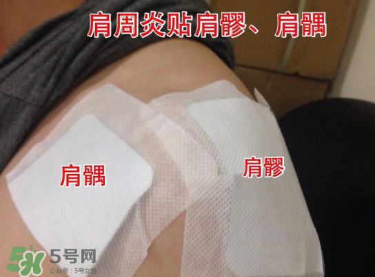 艾灸貼多少錢一盒?？艾灸貼一盒60裝多少錢？