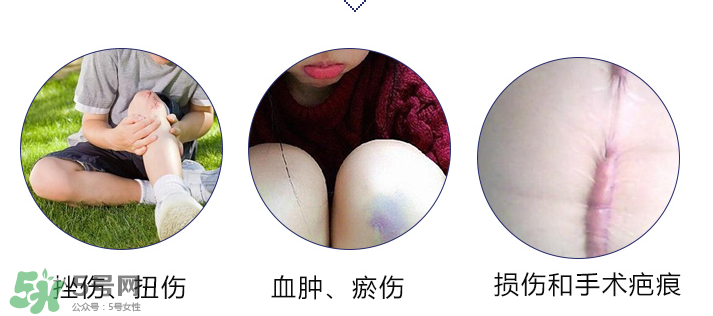 hirudoid除疤膏有效嗎？hirudoid去疤膏效果如何？