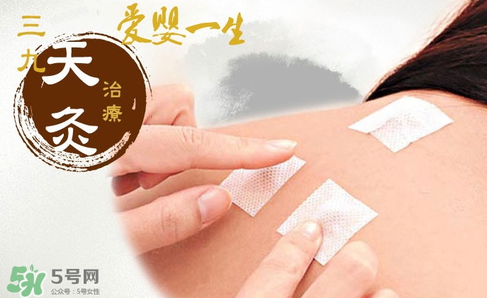 貼三伏貼可以吃魚嗎？貼三伏貼可以吃什么魚？