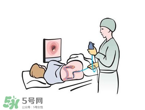 直腸癌怎么查出來(lái)的？直腸癌怎么判斷早晚期