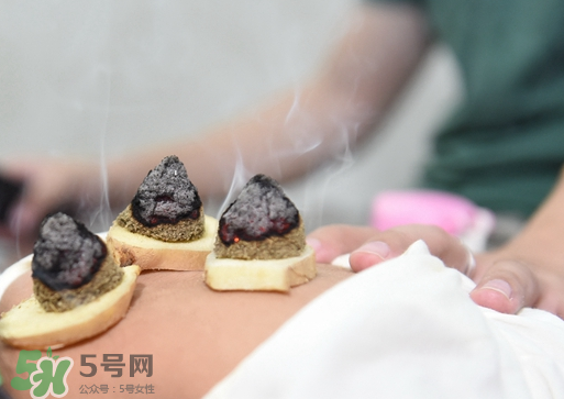 三伏灸什么人不能做？三伏灸適合哪些人？