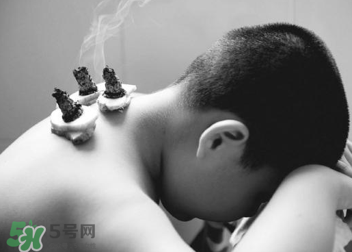 三伏灸什么人不能做？三伏灸適合哪些人？