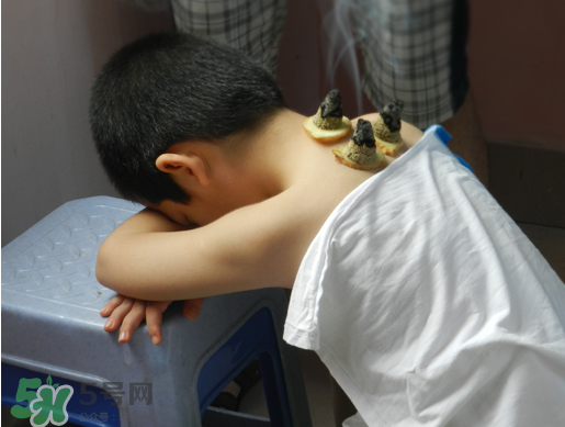 三伏灸什么時(shí)候做最好？?三伏灸可以晚上做嗎？