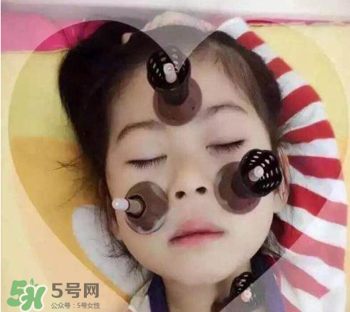 艾灸貼可以治咳嗽嗎？艾灸貼可以治退燒嗎？