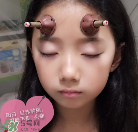 艾灸貼可以治咳嗽嗎？艾灸貼可以治退燒嗎？