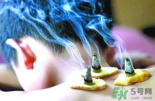 三伏灸什么時候開始灸？三伏灸怎么灸？