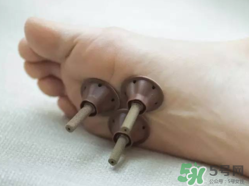 艾艾貼灸出水珠為什么？艾艾貼后有水珠要擦嗎？