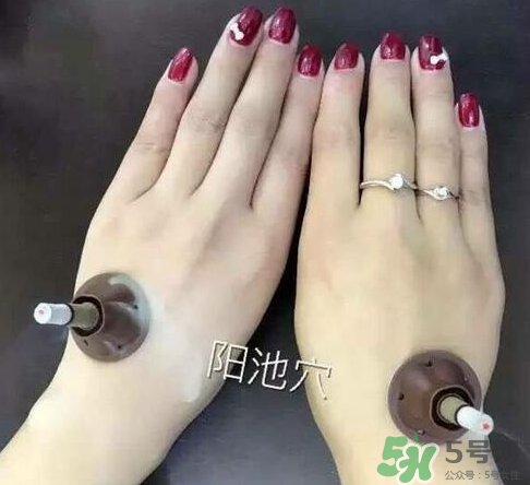 艾艾貼灸出水珠為什么？艾艾貼后有水珠要擦嗎？