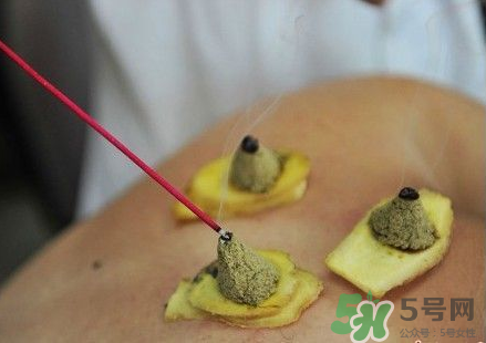 三伏灸可以自己灸嗎？三伏灸可以在家做嗎？
