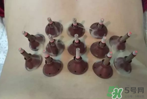 艾艾貼可以貼肚臍眼嗎？艾艾貼貼肚臍有什么作用？