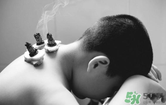 三伏灸要灸幾次？三伏灸要灸多久？