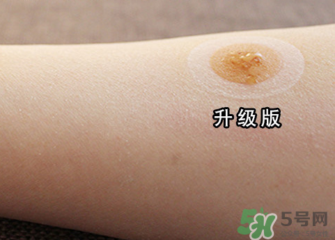 艾灸貼后有水泡怎么辦？貼艾灸貼應(yīng)注意些什么？