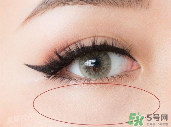 玻尿酸填充淚溝多久恢復(fù)自然？玻尿酸填充淚溝的危害