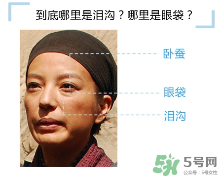 玻尿酸填充淚溝多久恢復(fù)自然？玻尿酸填充淚溝的危害
