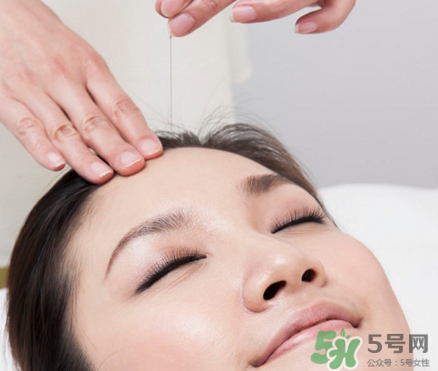 中醫(yī)院針灸一次多少錢？針灸后疼痛加重正常嗎