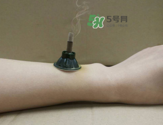 三伏天下雨可以艾灸嗎？三伏天下雨艾灸好嗎？