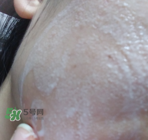 貝蜜清凈痘控油潔面啫喱怎么樣？貝蜜清祛痘控油潔面啫喱好用嗎？