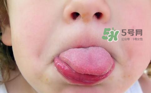 三伏天為什么濕氣重？三伏天為什么要注意祛濕？