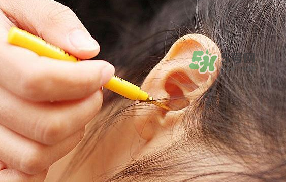 兒童耳屎成硬塊怎么辦？?jī)和撼捎矇K有危害嗎？