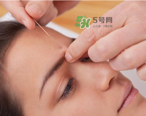 三伏天針灸有什么好處？三伏天針灸注意什么？