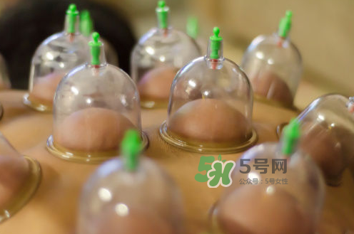 拔火罐是夏天好還是冬天好？什么時候拔火罐最合適？