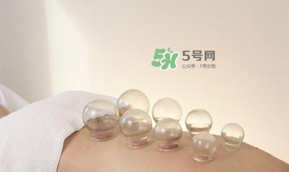 拔火罐是夏天好還是冬天好？什么時候拔火罐最合適？