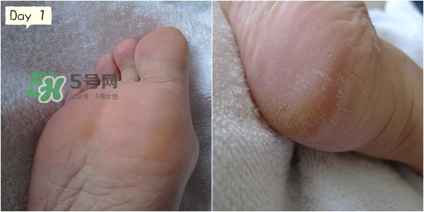 baby foot足膜怎么用？baby foot足膜使用方法