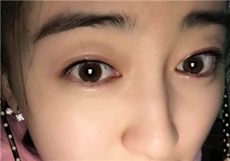 做美瞳線會(huì)不會(huì)掉睫毛？做美瞳線掉睫毛怎么辦？