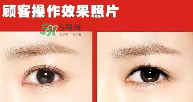 美瞳線有必要做嗎？做美瞳線多少錢？