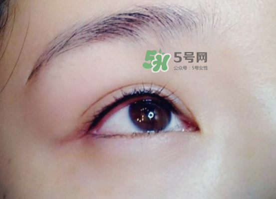 做美瞳線疼嗎？做美瞳線后要注意什么？