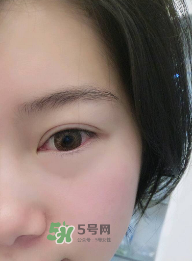 做美瞳線疼嗎？做美瞳線后要注意什么？