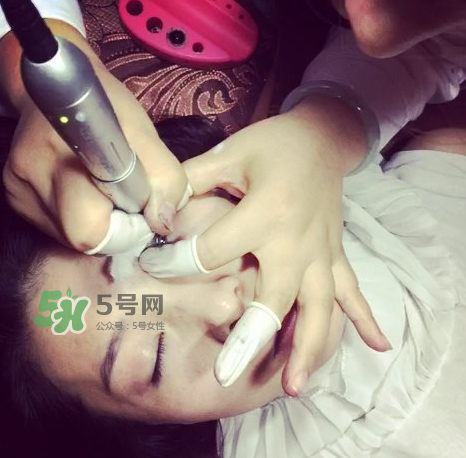 做美瞳線要打麻藥嗎？做美瞳線麻藥怎么敷？
